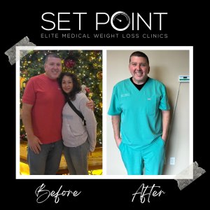 Before & After Gallery of Set Point Medical Weight Loss Clinic